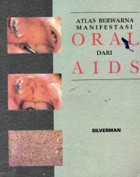 Image of Atlas Berwarna Manifestasi ORAL dari AIDS