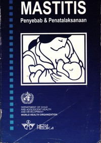 Image of Mastitis Penyebab & Penatalaksanaan