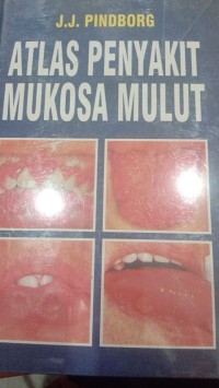 Image of Atlas penyakit mukosa mulut