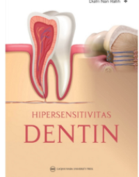 Image of Hipersensivitas Dentin