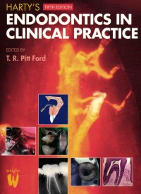 Image of Harty's Endodontics in Clinical Practice Fifth Edition