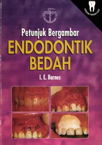 Image of Petunjuk Bergambar Endodontik Bedah