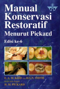 Image of Manual Konservasi Restoratif Menurut Pickard Ed Ke 6