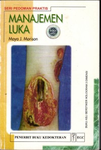 Image of Manajemen Luka