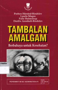 Image of Tambalan Amalgam: Berbahaya Untuk Kesehatan?